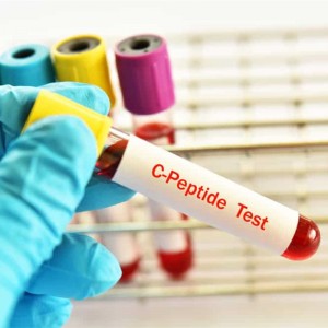 Why C-peptide can’t be used as a routine test for blood sugar management