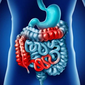 How to prevent Inflammatory Bowel Disease ?