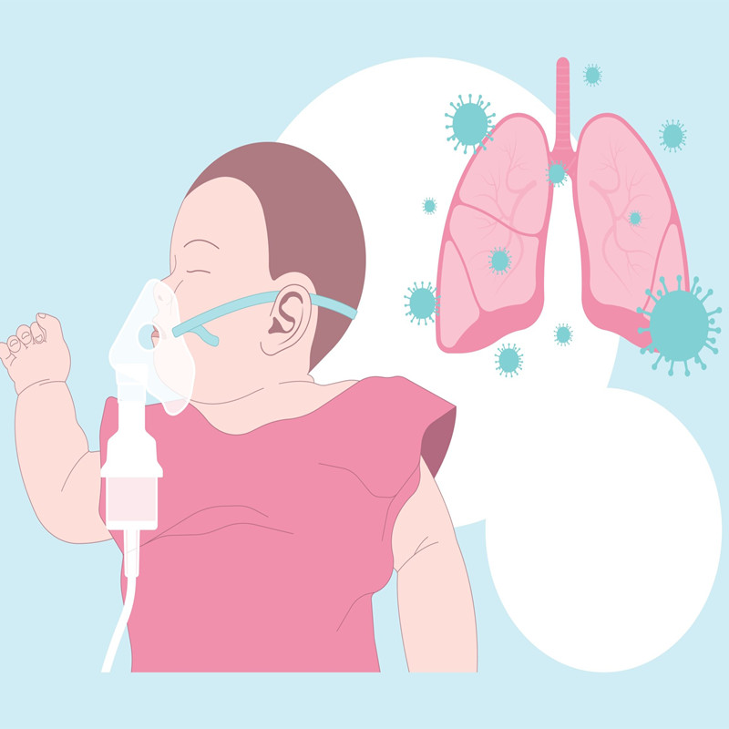 How to Prevent of respiratory syncytial virus infection ?